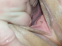 Cervix For Namsei (close-up)