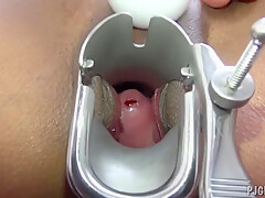 Getting Off With Gyno Speculum And Gynecolog