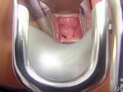 Getting Off With Gyno Speculum And Gynecolog