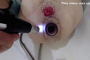 June 2023 Just My Hole #1 Post Op Orgasm Pussy Masturbation Teasing Orgasm With Lizzy Yum