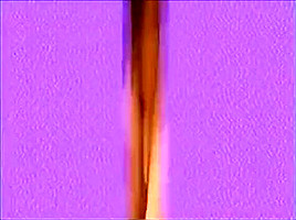 Lollypop teen 18+ 4