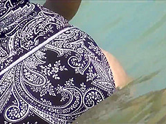 Milf Cellulite Butt