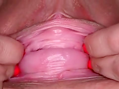 PJGIRLS Gaping queen - extreme prolapsed pussy fisted and gaped to cervix