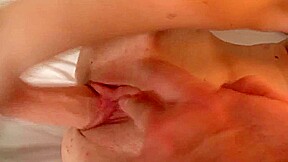 Pickel teen 18+ Vor Der Kamera